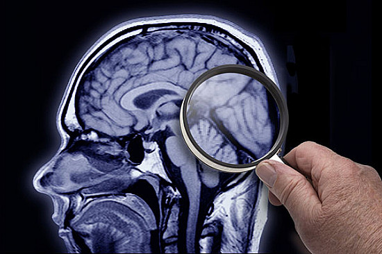 I'm too young to have Alzheimer's disease or dementia, right? featured image