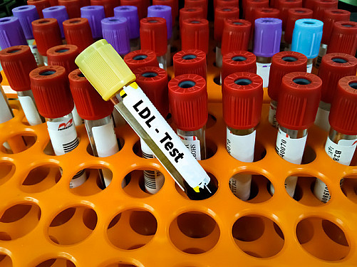 Trying to lower stubbornly high LDL cholesterol? featured image