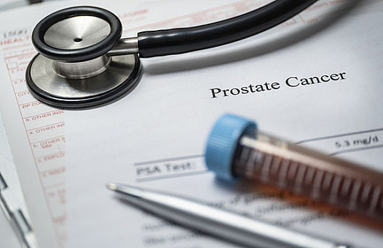 Prostate cancer: How often should men on active surveillance be evaluated? featured image