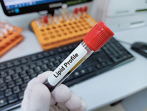 What is non-HDL cholesterol? featured image