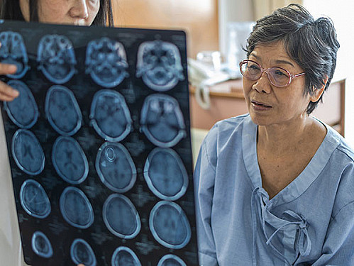 A new Alzheimer's drug has been approved. But should you take it? featured image