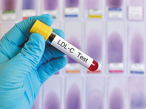 New insights about an inherited form of high cholesterol featured image